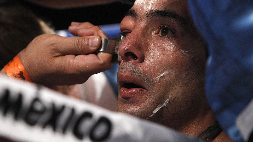 30-летний аргентинец Лукас Матиссе лидировал в первых раундах, пока не получил серьезную гематому под глазом