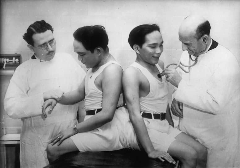 Сросшиеся близнецы Лусио и Симплисио Годино из Филиппин, около 1930