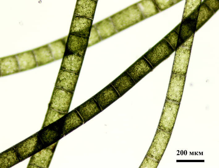 Нити водоросли на малом увеличении микроскопа