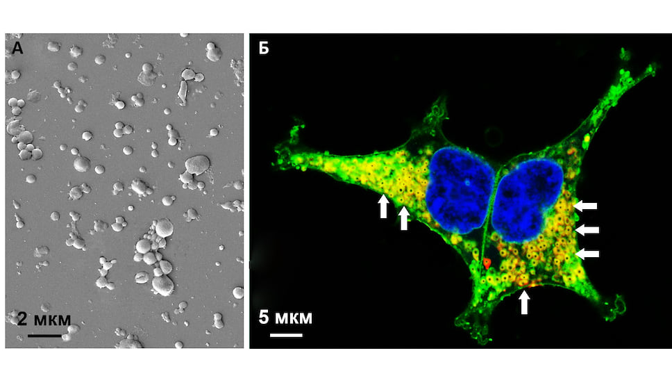 А – Биосовместимые мембранные везикулы. Масштабный отрезок – 2 микрометра.
Б – Доставка мембранных везикул в целевые клетки (везикулы внутри клетки отмечены стрелками). Масштабный отрезок – 5 микрометров