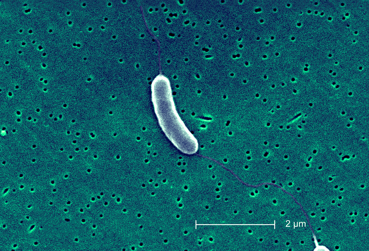 Vibrio vulnificus