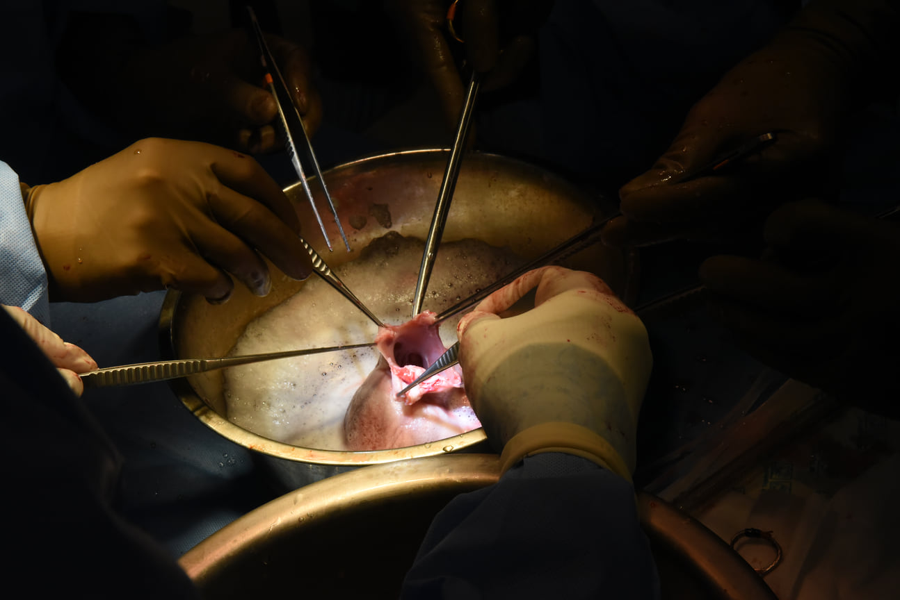 Хирурги готовят генетически модифицированное сердце свиньи в лаборатории ксенотрансплантации Медицинской школы Университета Мэриленда, 20 сентября 2023 года
