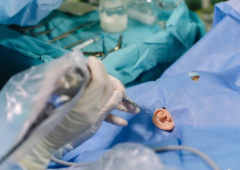 В Клиническом центре Сеченовского университета стартовали операции по восстановлению барабанной перепонки с помощью эквивалентов, которые создают из собственных клеток пациента.