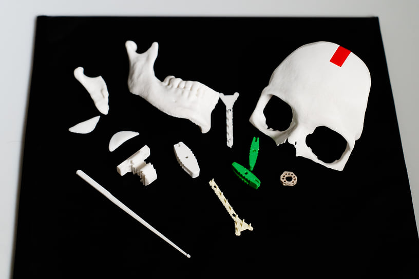 Из полиэфирэфиркетона разрабатываются спинальные кейджи, имплантаты для восстановления костей головы и шеи после травм