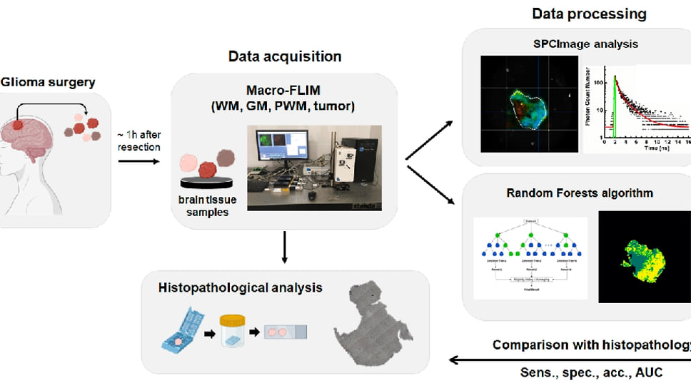 Ученые предложили технологию для высокоточной диагностики опухолей головного мозга. Метод, основанный на анализе флуоресценции — собственного свечения — тканей, позволил с точностью до 87% выявить новообразования и определить зоны инфильтрации — места, где раковые клетки проникают в окружающие здоровые ткани. Схема эксперимента