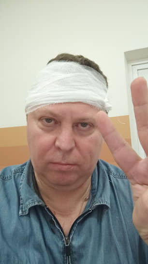 Михаил Матвеев после нападения 