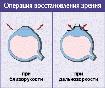 Схема операции