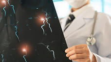 Очень низкий уровень ЛПНП сокращает риск повторного инсульта