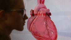 Сердечная помощь