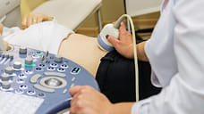 В Курганской области количество абортов в 2025 году снизилось на 25%