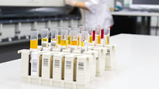 В Удмуртии скончалось еще 15 человек с коронавирусом