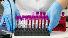 За сутки от короновируса в Удмуртии умерло еще 16 человек