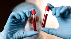 227 новых случаев COVID-19 выявили в Удмуртии