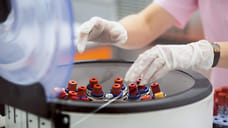 226 жителей Удмуртии заразились коронавирусом