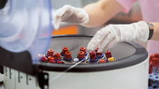 В Удмуртии от коронавируса скончалось еще 15 человек