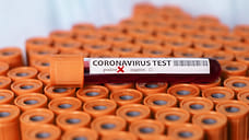 394 новых случая заражения COVID-19 зарегистрировано в Удмуртии