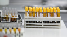 В Удмуртии анализ крови на антитела к коронавирусу может получить юридический статус