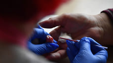 758 новых случаев ВИЧ-инфекции выявили в Удмуртии в 2021 году