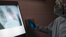 За сутки в Удмуртии коронавирусом заразились 300 человек