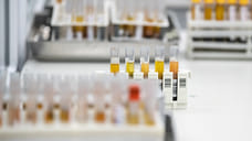 Суточная заболеваемость ковидом в Удмуртии достигла почти 300 человек