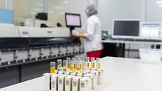 1 570 жителей Удмуртии заразились COVID-19 за сутки