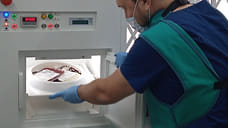 Аппарат для облучения крови впервые появился на станции переливания в Удмуртии