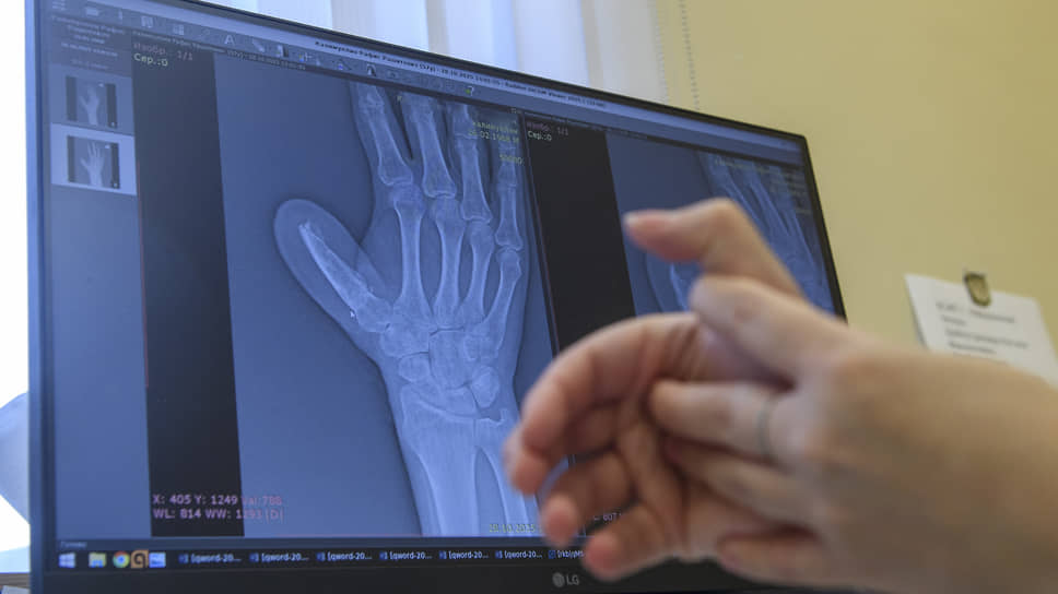 В Казани восстановили отрезанный болгаркой палец
