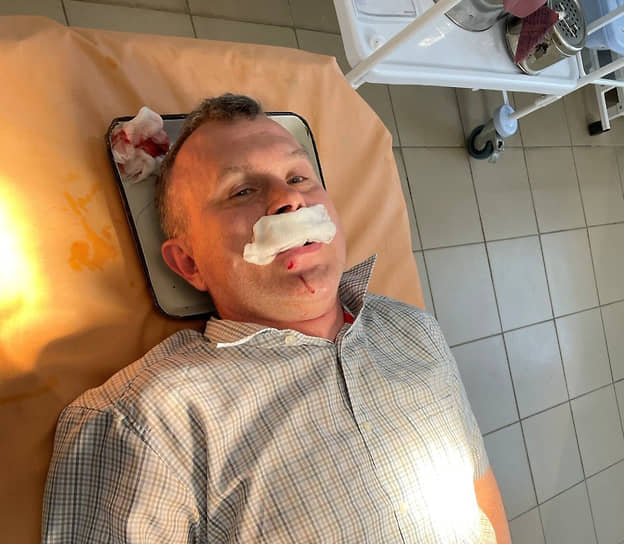 Экозащитник Дмитрий Трунин, пострадавший в драке на свалке в Арзамасском районе