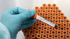 Еще три лаборатории в Перми смогут проводить окончательные тесты на COVID-19