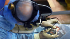 Офтальмологи Петербурга внедрили новую технологию операции при редкой болезни глаз