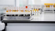 На Дону циркулируют семь негриппозных вирусов