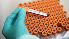 Новый коронавирус подтвержден уже у 36,604 тыс. пациентов в Черноземье