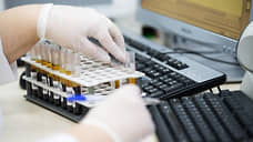 Заболеваемость ВИЧ-инфекцией снизилась на 39% в Белгородской области