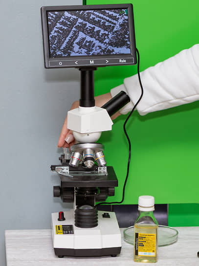 Так выглядит под микроскопом сычужный фермент. Благодаря ему молоко сворачивается, образуя сырный сгусток